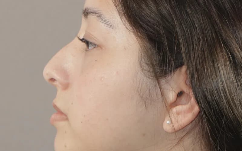 Danna Paula · Perfil derecho · Antes