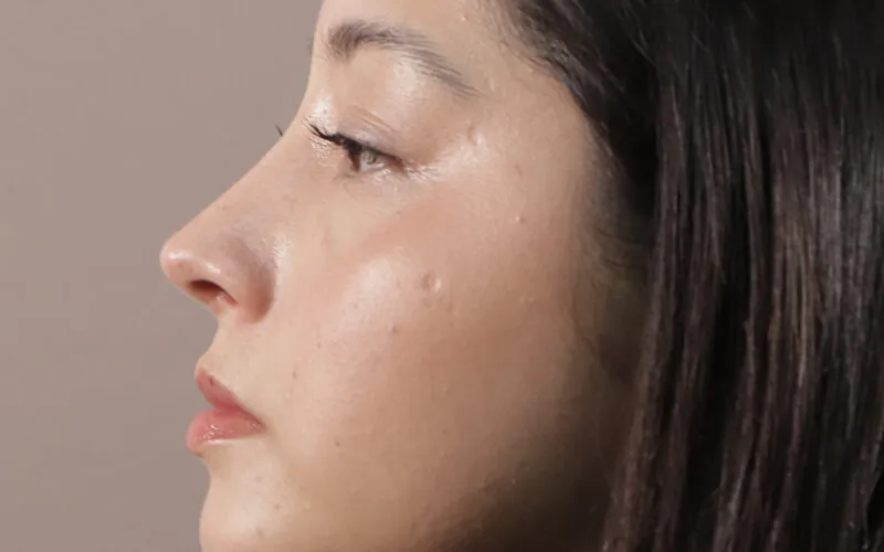 Danna Paula · Perfil derecho · Después