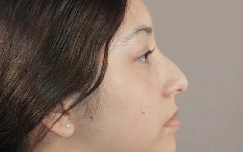 Danna Paula · Perfil izquierdo · Antes