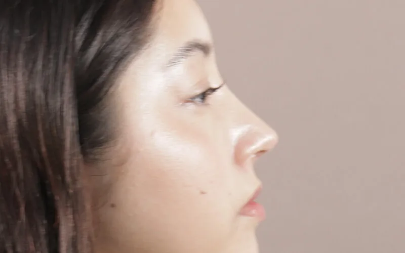 Danna Paula · Perfil izquierdo · Después