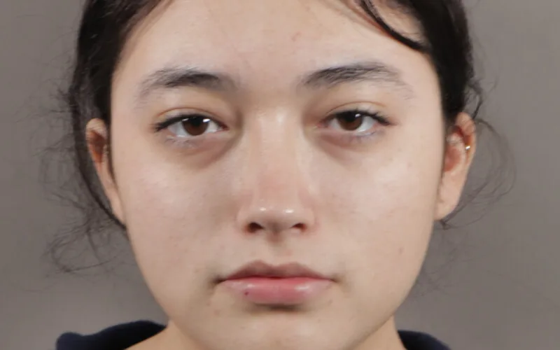 Evelyn · Frente · Después