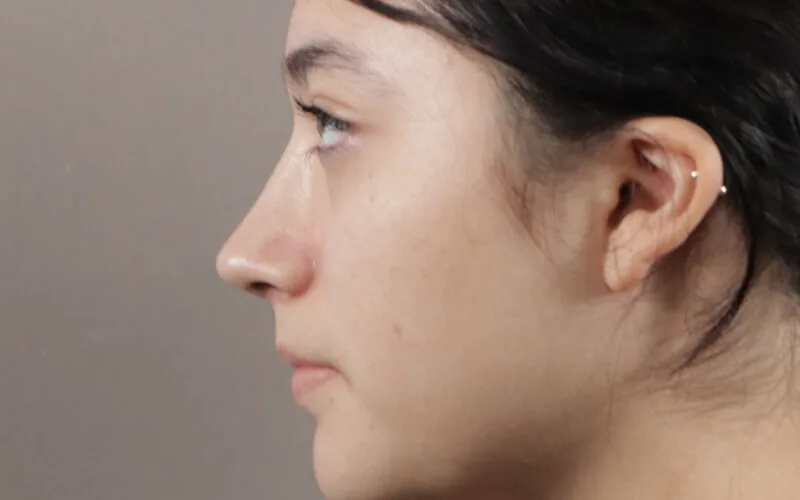 Evelyn · Perfil derecho · Después