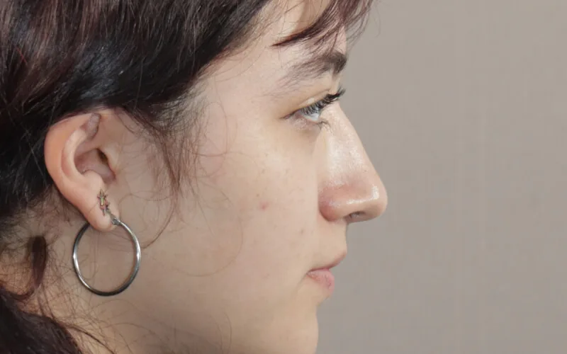 Evelyn · Perfil izquierdo · Antes
